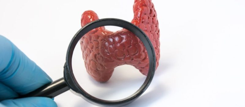 Hangi tiroid nodullerinde ameliyat gerekir Hangi tiroid nodüllerinde ameliyat gerekir?