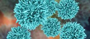 Medüller Tiroid Kanseri Medullar Tiroid Xərçəngi