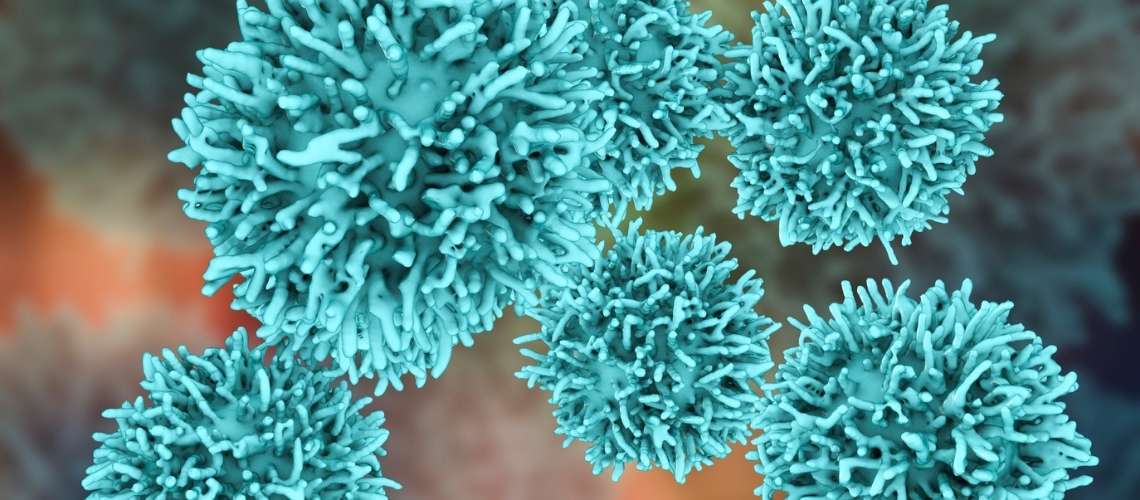 Medüller Tiroid Kanseri Medullar Tiroid Xərçəngi