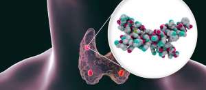 Parathormon nedir? Parathormon yüksekliği neye sebep olur?