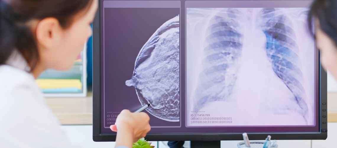 Meme Kanseri Nasil Anlaşilir Meme Kanseri Nasıl Anlaşılır?