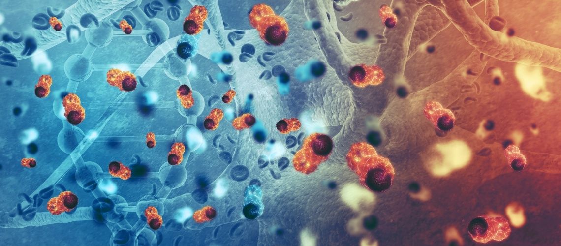 Meme Kanseri Kemik Metastazi Meme Kanseri Kemik Metastazı Belirtileri ve Tedavi Süreci