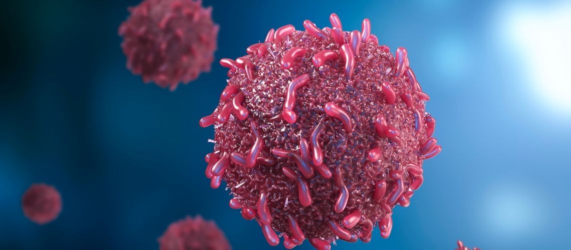 Meme Kanseri Omurga Metastazi Meme Kanseri Omurga Metastazı Belirtileri ve Tedavi Süreci