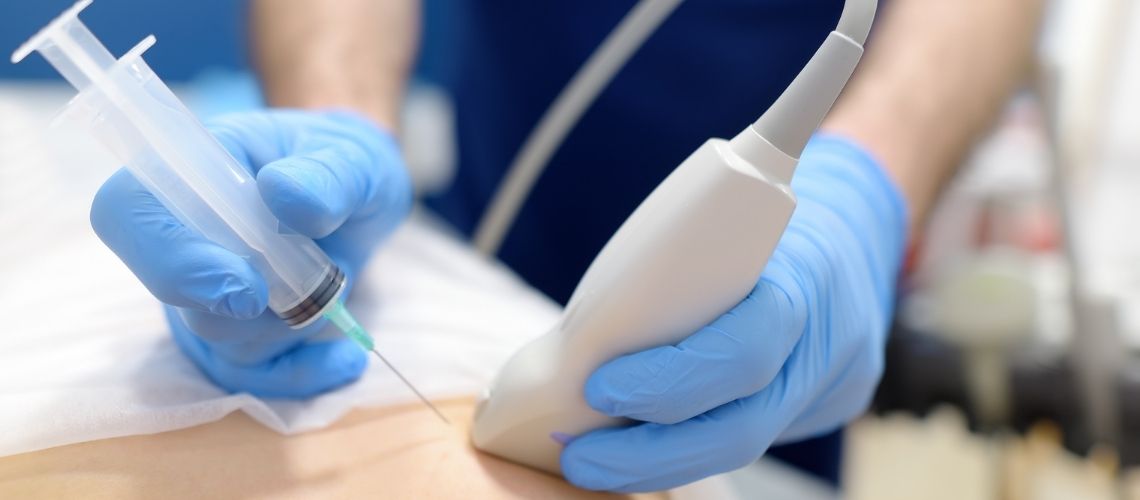 Sentinel Lenf Nodu Biyopsisi Sentinel Lenf Nodu Biyopsisi