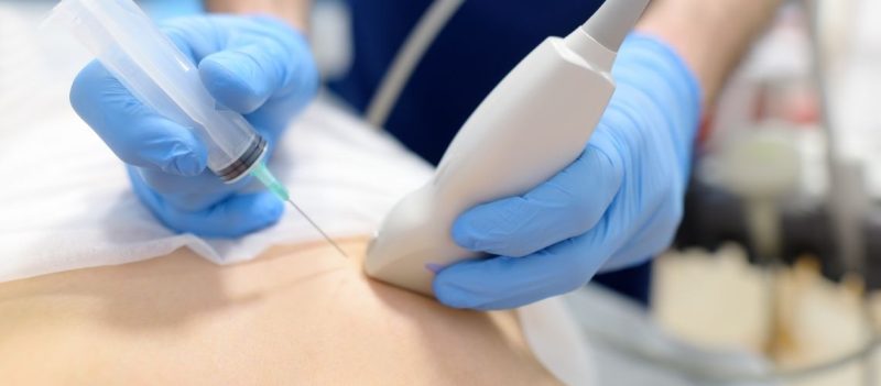 Biyopsi Nedir Biyopsi Nasil Yapilir Biyopsi Nedir? Biyopsi Nasıl Yapılır?